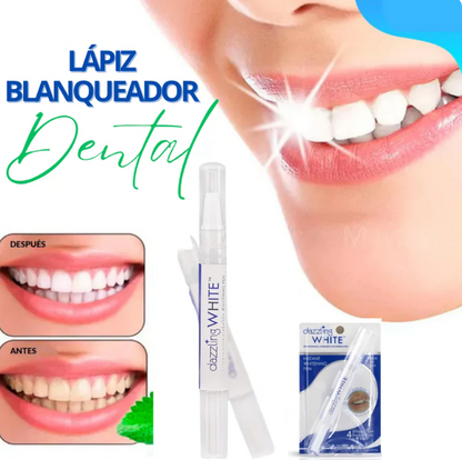 LAPIZ BLANQUEADOR DENTAL-TOP DE VENTAS